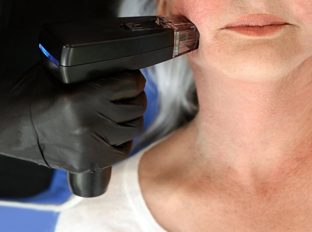 jawline filler