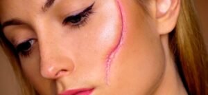Facial Scars in Dubai: Top Clinics & Expert Solutions