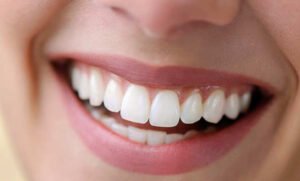 How Dental Implants Prevent Bone Loss Over Time
