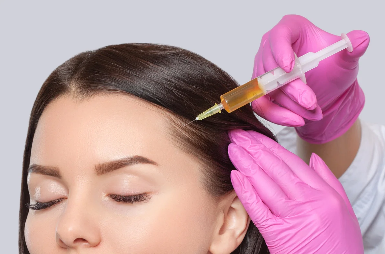 How Do Hair Fillers Help Restore Thinning Hair?