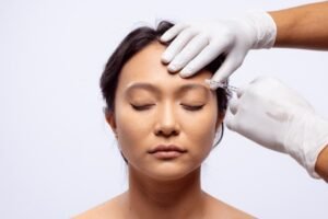Brow Lift