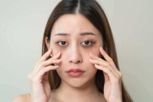 What Causes the Need for Dark Circles Treatment