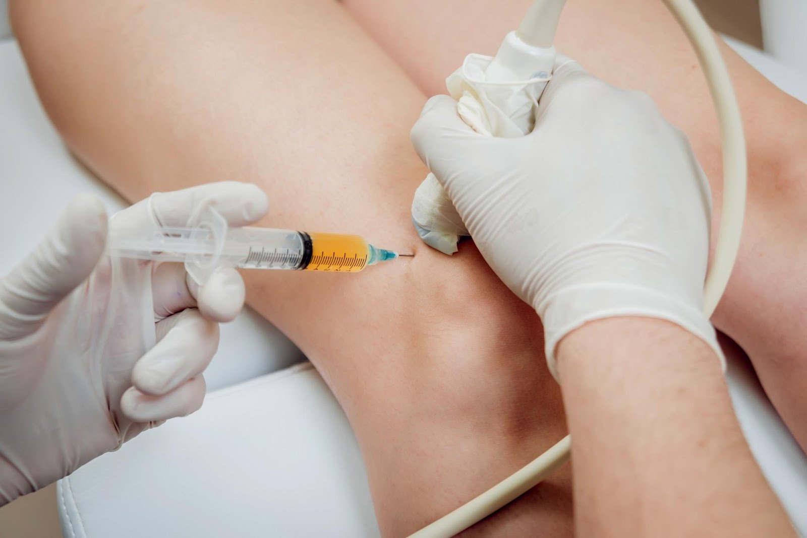 What Results to Expect from PRP Injections for Knees
