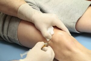 What is the Cost of Stem Cell Therapy for Your Knees?