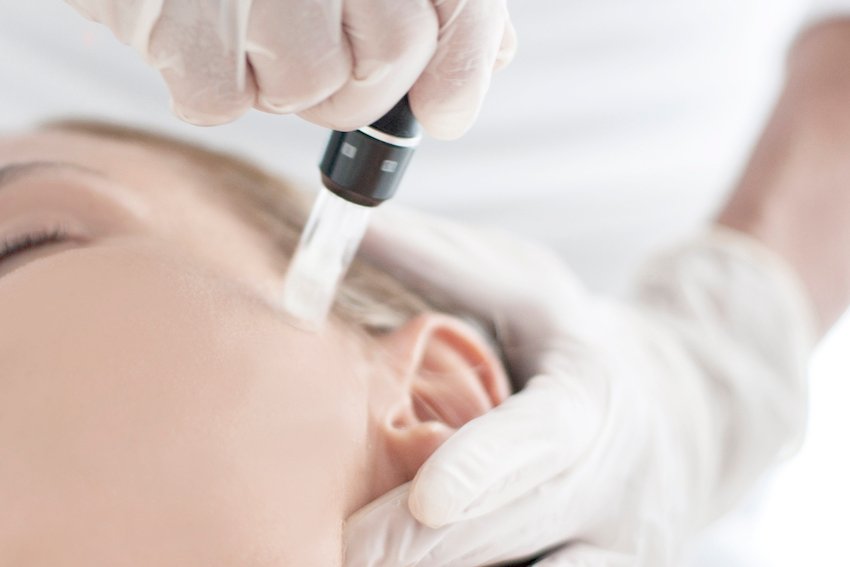 Dermapen Treatment Dubai for Reducing Deep Scars