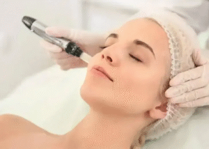 Does Skin Rejuvenation Improve Fine Lines