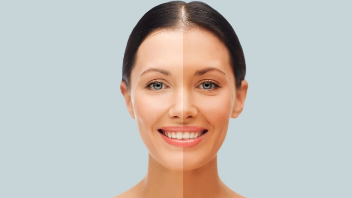 Is Facial for Skin Whitening Really Effective