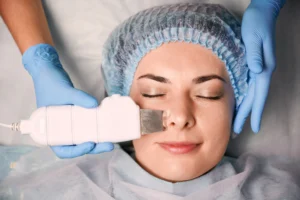 Microneedling Toronto