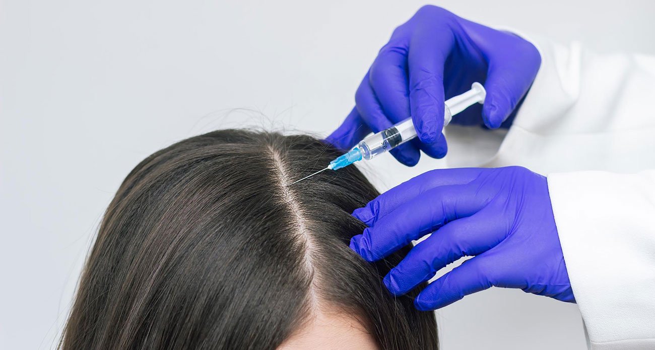 What Results Exosome Therapy for Hair Loss Delivers