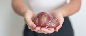 liver transplant