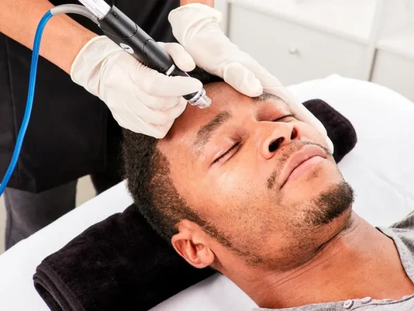 Does Hydrafacial for Men Deliver Instant Results