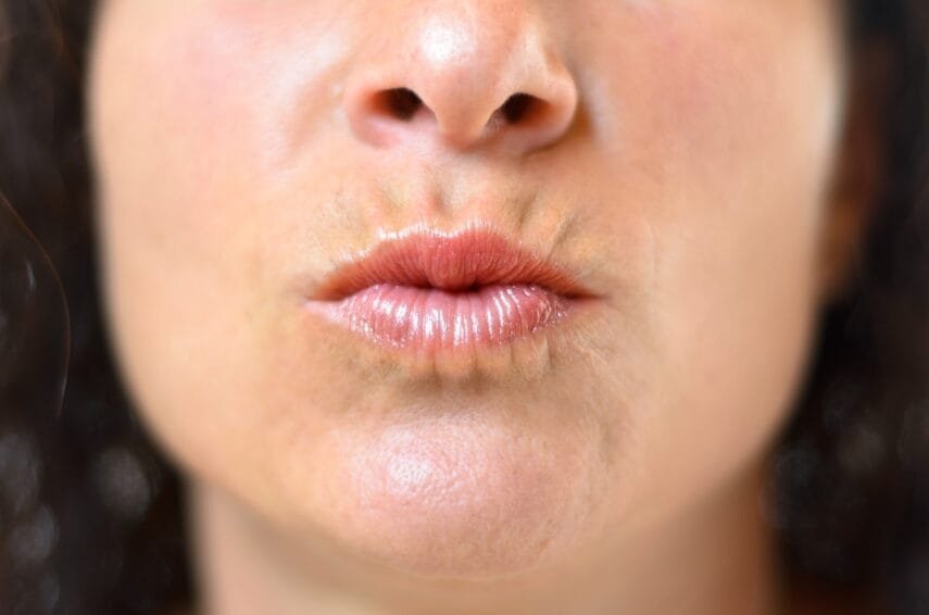 Dose Smoker’s Lips Treatment Improve Lip Texture