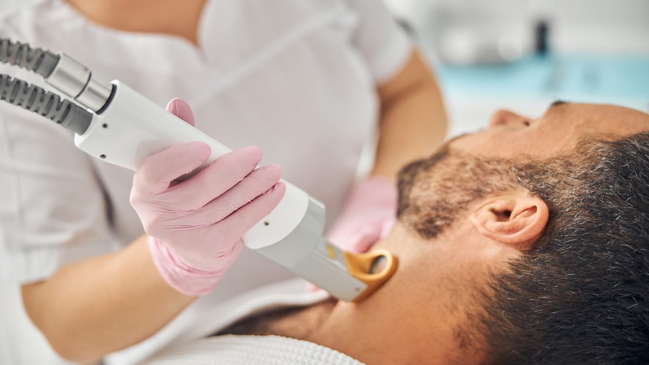 How Beard Laser Hair Removal Boosts Confidence