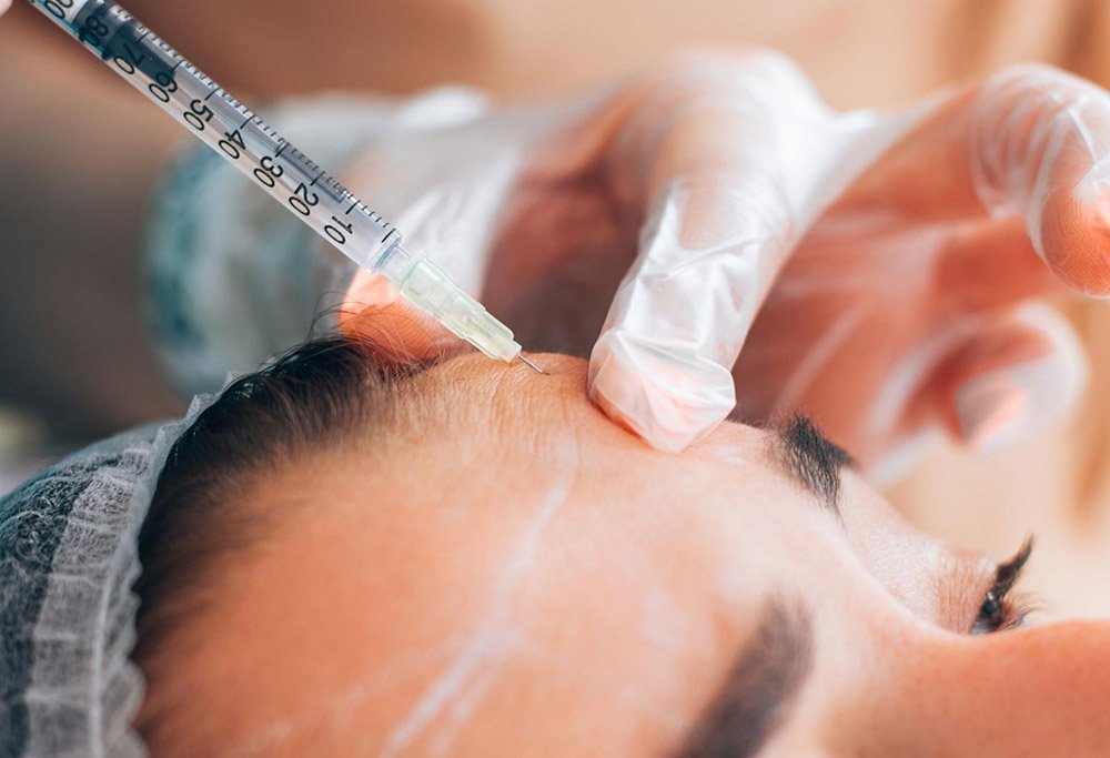 How Botox Injection for Wrinkles Reduces Fine Lines