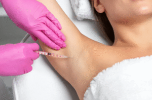 How Botox for Sweaty Glands Improves Daily Comfort