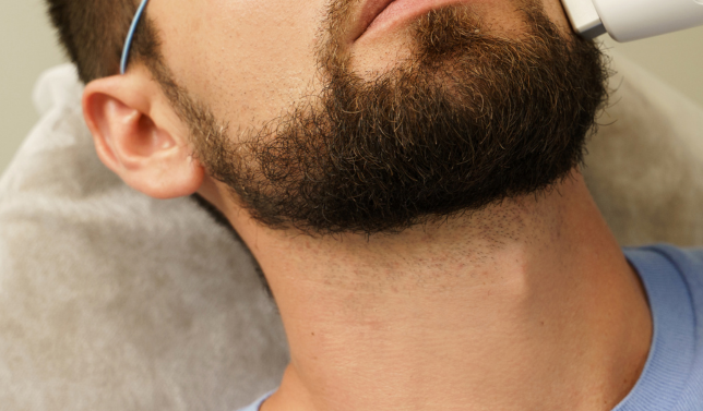 How Effective Is Beard Laser Hair Removal