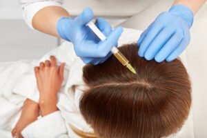 How PRP Hair Treatment Improves Density Fast?