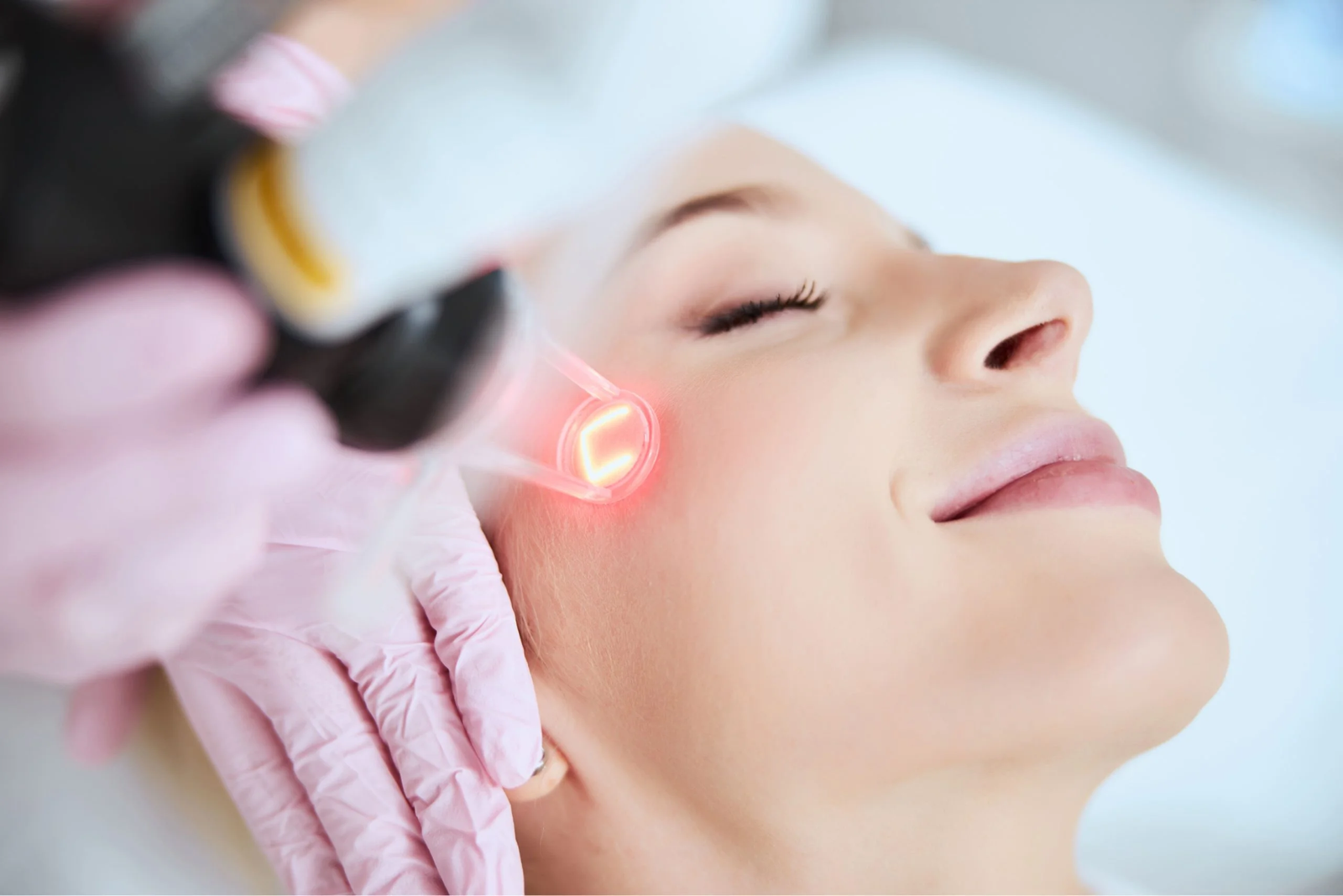 How Pico Laser Treatment Brightens Dull Skin