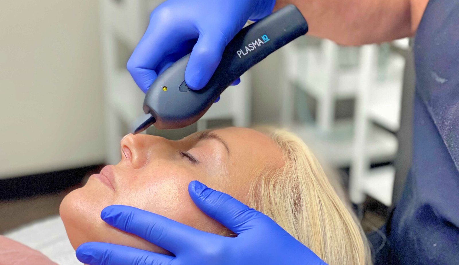 How Plasma Pen Treatment Improves Skin Texture