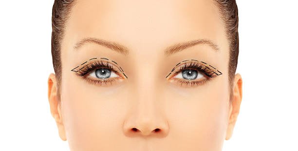 Is Blepharoplasty a Permanent Eye Solution