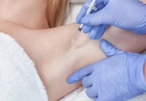 Is Botox for Sweaty Glands Right for You