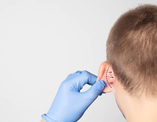 Is Ear Reshaping Worth the Cosmetic Investment