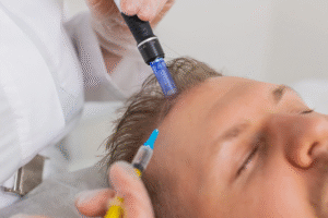 Is Exosome Therapy Cost Higher Than PRP