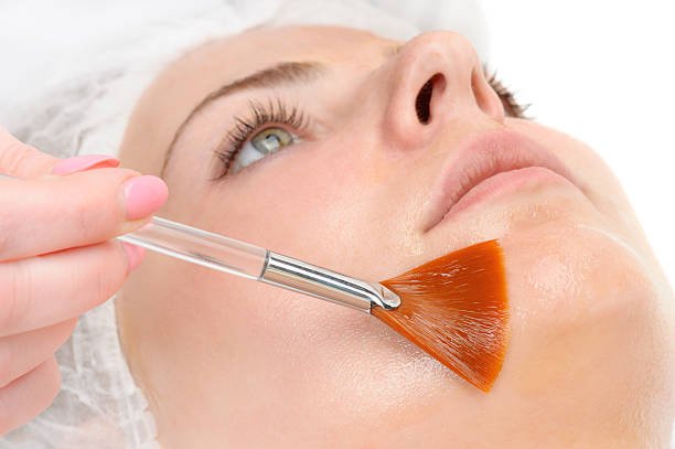 Is a Chemical Peel Worth the Investment?