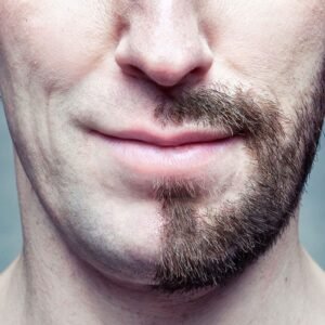 Mustache Hair Transplant Dubai Clinics Going Digital