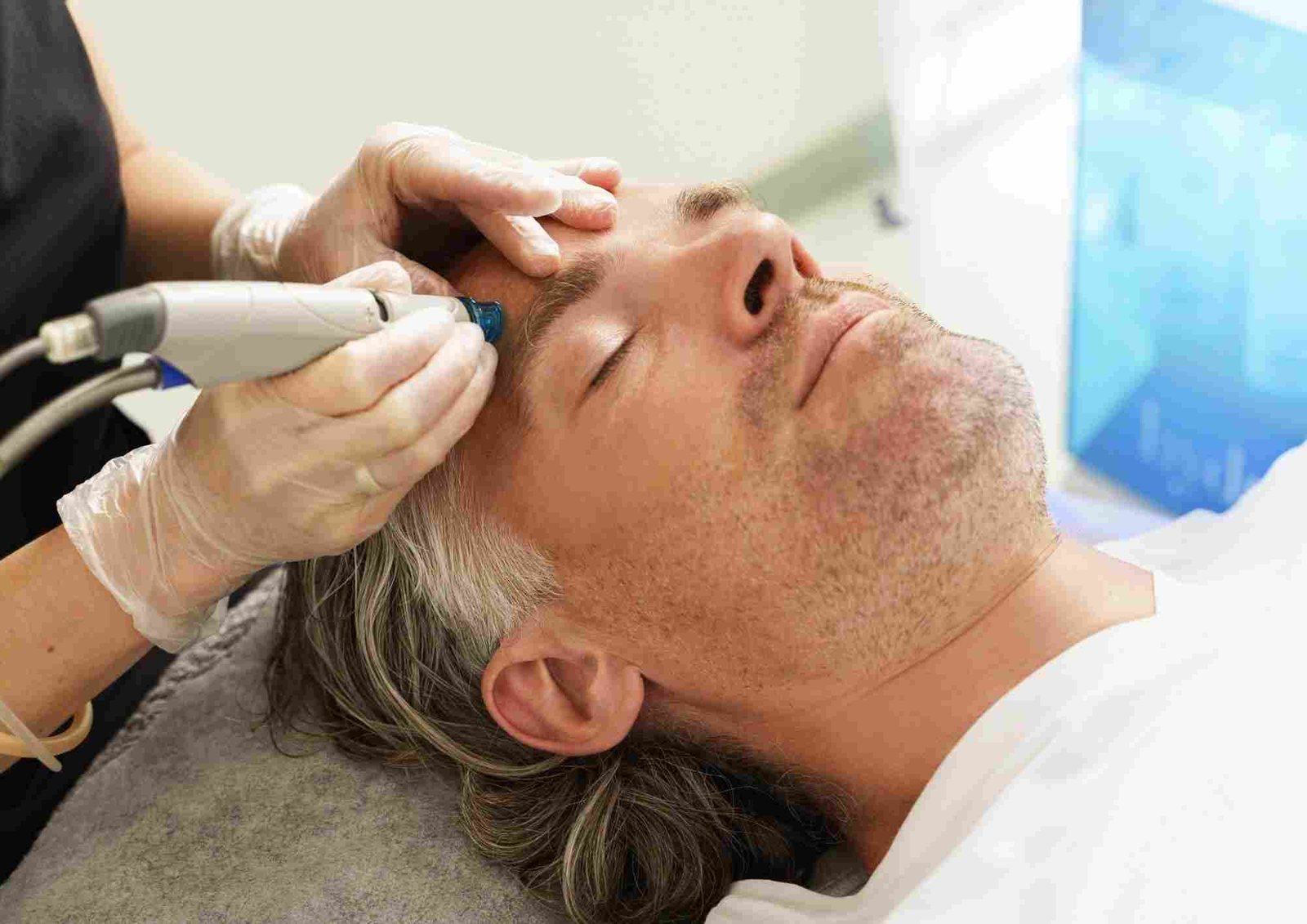 What Skin Issues Pico Laser Treatment Solves