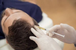 Does PRP Hair Treatment Last for Long?