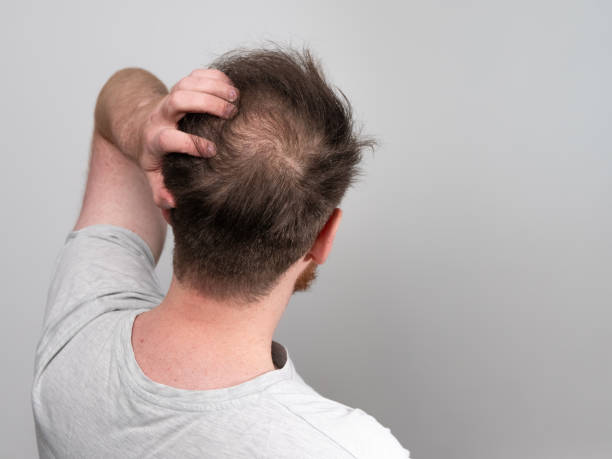 How Hair Loss Treatment Boosts Growth