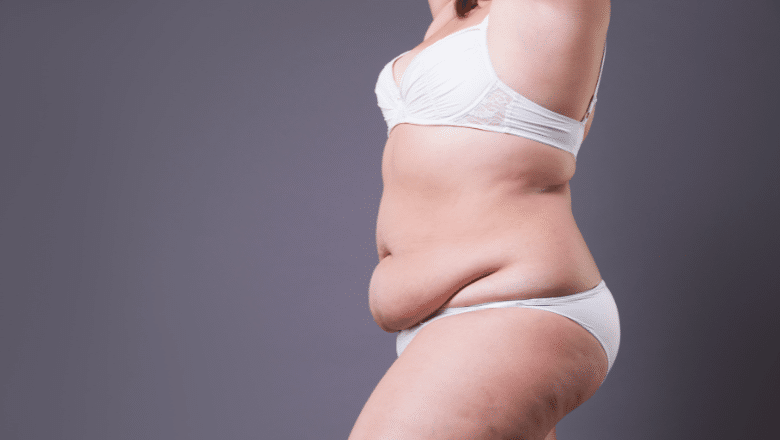 How Laser Liposuction Creates Natural Results