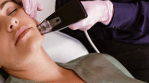 How Morpheus8 Restores Youthful Appearance