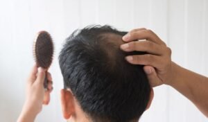 Is Hair Loss Treatment Right for You