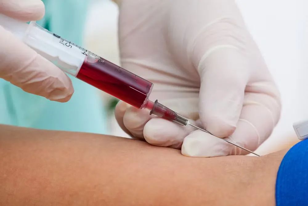 What Can a Blood Test Tell About Immunity