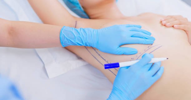 What Makes Breast Augmentation Surgery Safe