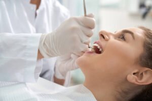 What Teeth Whitening Options Are Trending Now