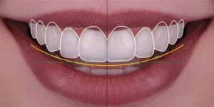 cosmetic dental makeover
