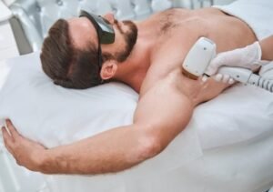Does Men’s Laser Hair Removal Cause Irritation?