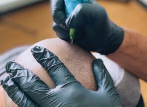 Does Scalp Micropigmentation Fade Over Time?