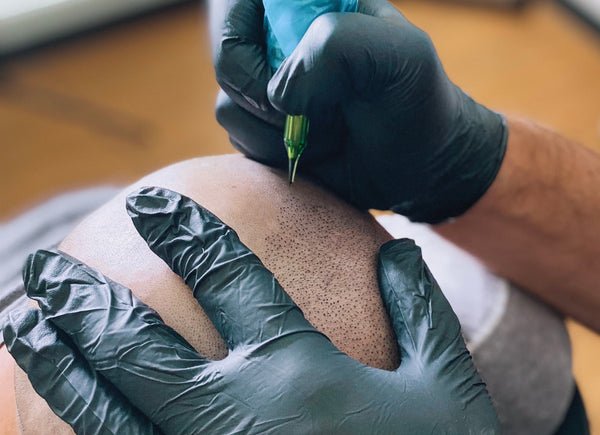 Does Scalp Micropigmentation Fade Over Time?