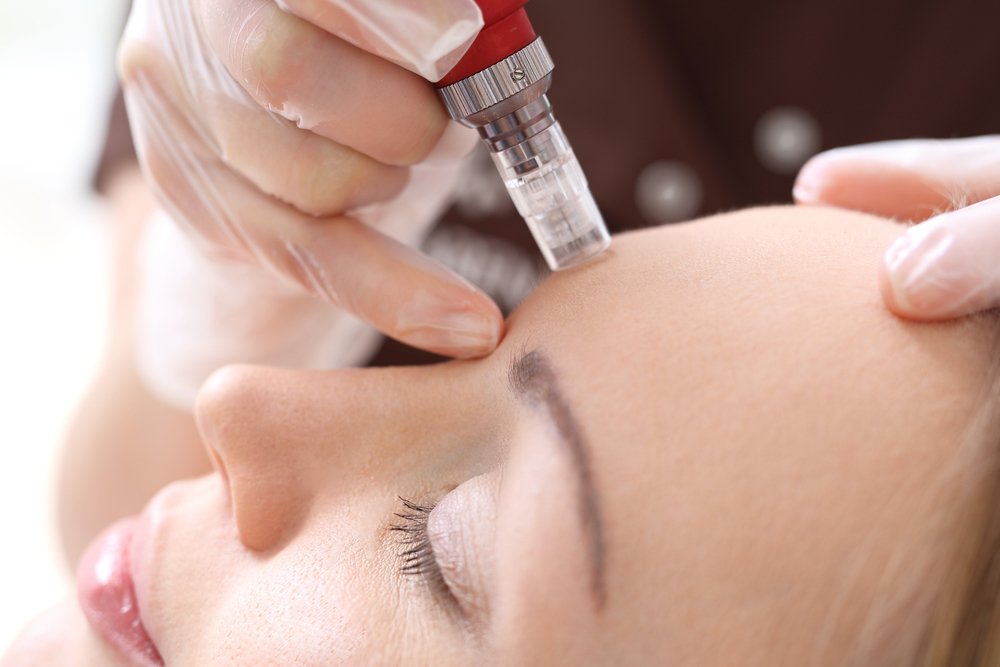 How Effective Is Mesotherapy Treatment?
