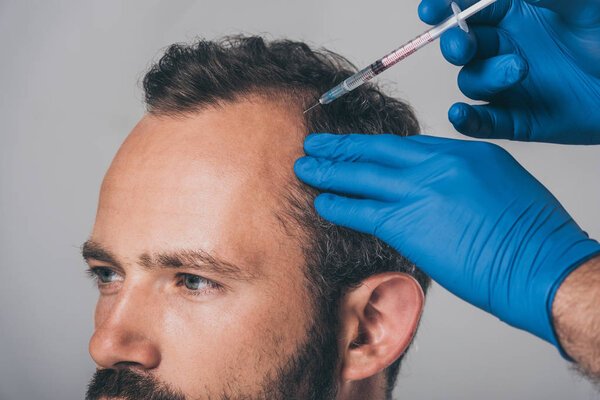 How Effective Is PRP Hair Treatment Today?