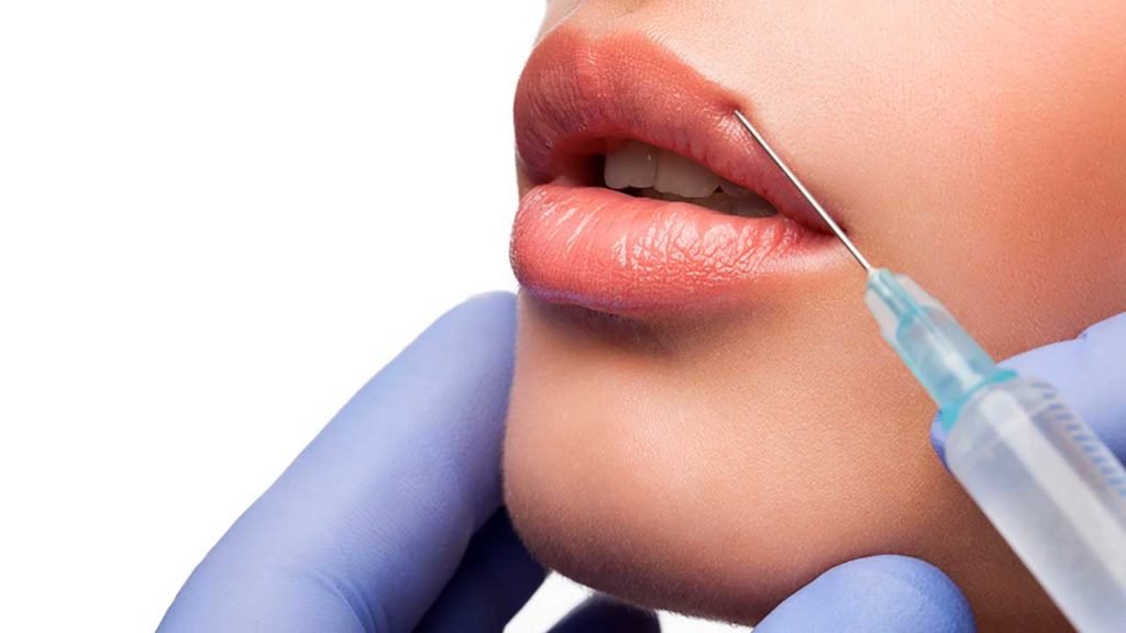 lip fillers nottingham