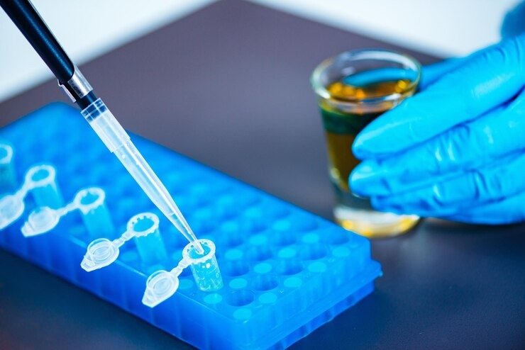 Protein Concentration SDS PAGE