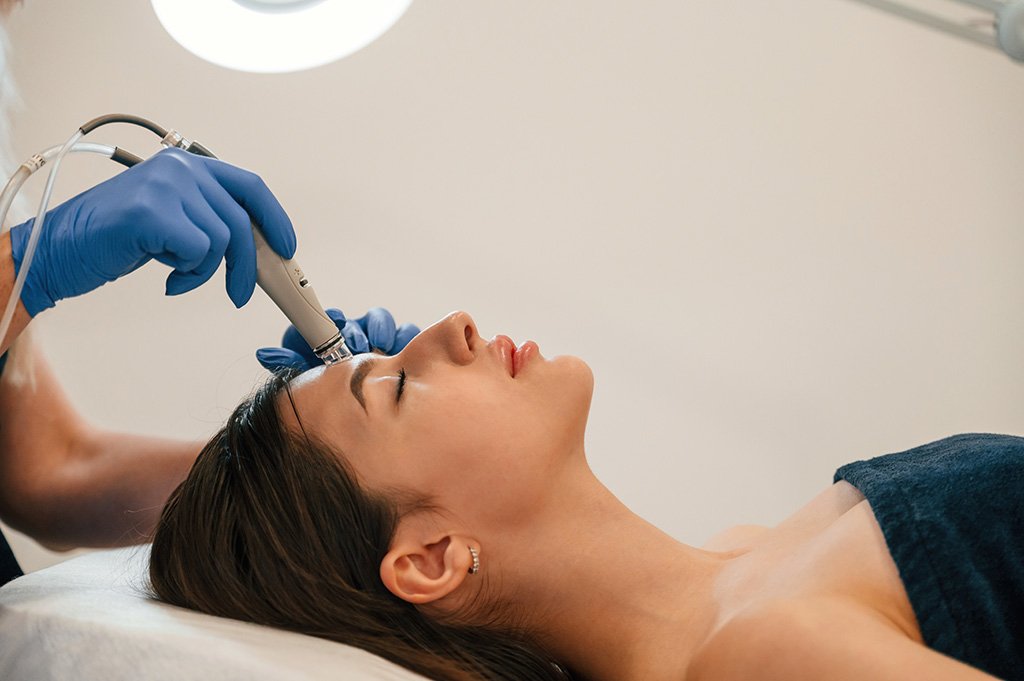 What Makes Dermapen Treatment Popular?