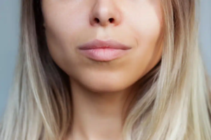 What Areas Does Buccal Fat Removal Improve?