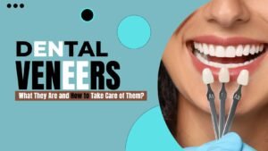 veneers for teeth in London