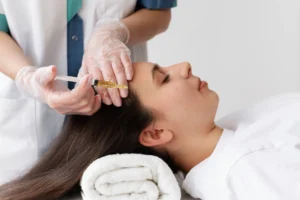 microneedling with PRP